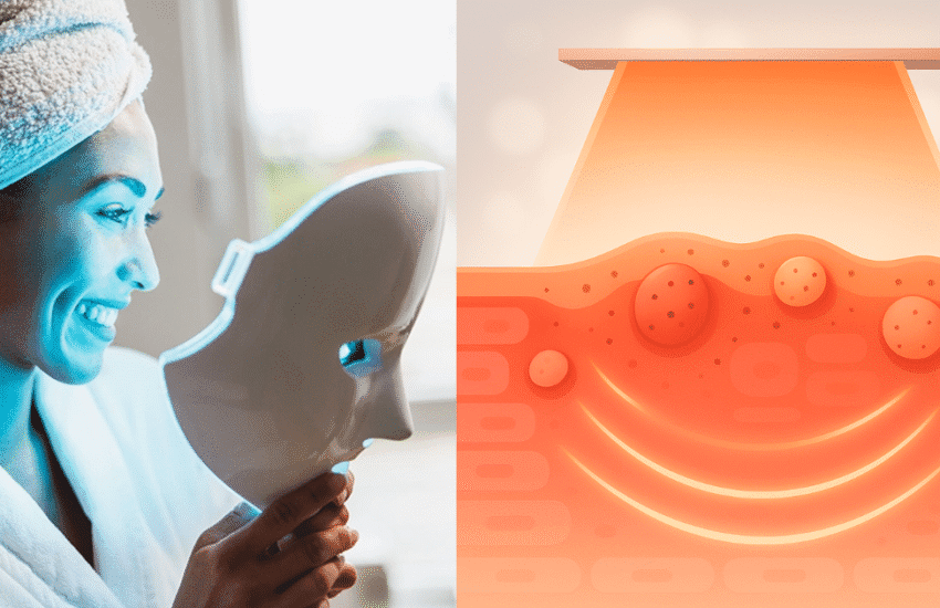 best led mask for acne