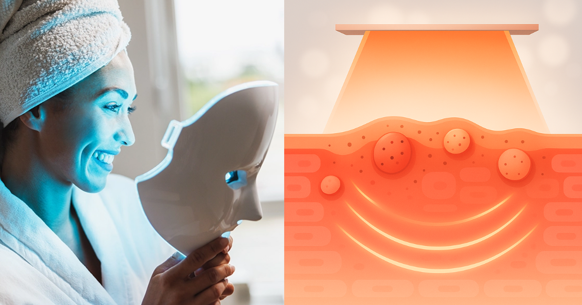 best led mask for acne