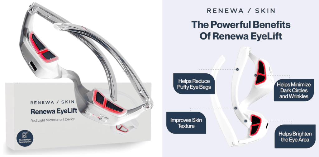 Renewa eyelift benefits